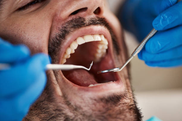Best Emergency Root Canal Treatment in Pine Bluff, AR
