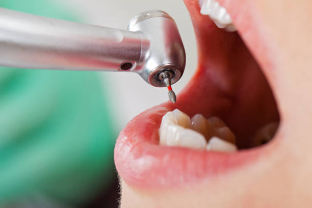 Best Emergency Cosmetic Dentistry in Pine Bluff, AR